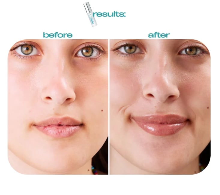 ✨BP Spicule Plumping Lip Shot